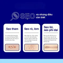 Kem Làm Mờ Sẹo Contractubex 20g - Dưỡng ẩm, Giảm Thâm, Cải Thiện Da Sau Tổn Thương, Đặc Trị Sẹo Lồi, Hàng Nội Địa Đức