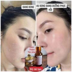 Combo Kem Face Tái Tạo Da Trắng Sáng - Sản Phẩm Dưỡng Da Chăm Sóc Mụn, Nám, Tàn Nhang, Cho Da Căng Bóng Mịn Màng