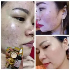 Combo Kem Face Tái Tạo Da Trắng Sáng - Sản Phẩm Dưỡng Da Chăm Sóc Mụn, Nám, Tàn Nhang, Cho Da Căng Bóng Mịn Màng