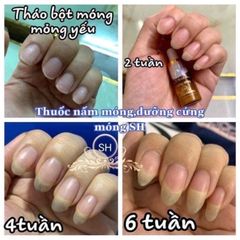 Combo 10 Serum Chống Nấm Móng & Hư Khoé - Giảm Đau & Hiệu Quả Nhanh 4ml, Phù Hợp Cho Nail Salon