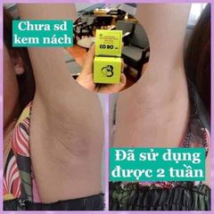 Kem Khử Mùi Hôi Nách Cô Bơ 30gr - Giảm Thâm, Ngăn Tiết Mồ Hôi, Dưỡng Trắng Da Từ Thiên Nhiên, Tiện Dụng Xuất Xứ Việt Nam