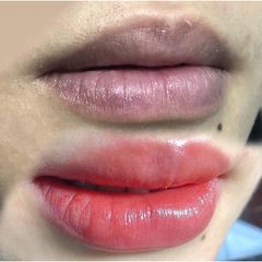Combo Dưỡng Môi Collagen Thiên Di - Giảm Thâm, Cấy Hồng Tự Nhiên, Môi Mịn Màng Sau Phun Xăm, Dưỡng Hồng Môi Hiệu Quả