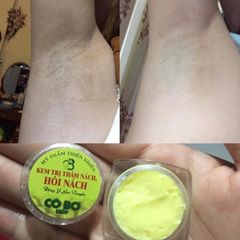 Combo 2 Hộp Kem Khử Hôi Nách Thâm Nách - Chăm Sóc Vùng Cánh Tay Trắng Sáng, Giảm Mùi Hôi Hiệu Quả Từ Thiên Nhiên