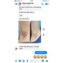 Combo 3 Lọ Kem Loại Bỏ Thâm Nách & Khử Hôi Nách Cô Bơ - Điều Chế Từ Thảo Dược, An Toàn Cho Da, Lọ Nhỏ 8gr
