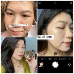 Kem Dưỡng Trắng Da Demejine Hàn Quốc - Mờ Thâm, Nám, Se Khít Lỗ Chân Lông - Hộp 20g Bảo Vệ Da Chất Lượng Cao