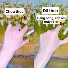 Dầu Dưỡng Thể Body Oil 4% BHA - Cấp Ẩm, Săn Chắc Da, Thấm Nhanh, Phù Hợp Với Da Khô, Sần, Tăng Độ Đàn Hồi