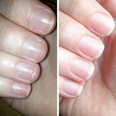 Dưỡng Móng Collagen - Tăng Cường Sức Khỏe Móng, Giúp Móng Hồng, Chắc Khỏe, Dài Nhanh và Phục Hồi Móng Yếu, An Toàn Cho Mọi Lứa Tuổi