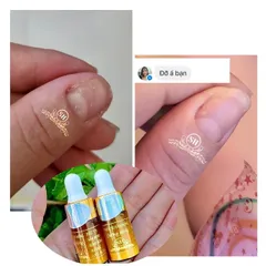 Serum Phục Hồi Móng - Combo 2 Chai 4ml Trị Nấm Móng, Hư Khoé, Bọng Móng - Giải Pháp Chăm Sóc Móng Chân Tay Hiệu Quả