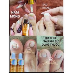 Serum Phục Hồi Móng - Combo 2 Chai 4ml Trị Nấm Móng, Hư Khoé, Bọng Móng - Giải Pháp Chăm Sóc Móng Chân Tay Hiệu Quả