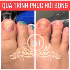 Serum Phục Hồi Móng - Combo 2 Chai 4ml Trị Nấm Móng, Hư Khoé, Bọng Móng - Giải Pháp Chăm Sóc Móng Chân Tay Hiệu Quả