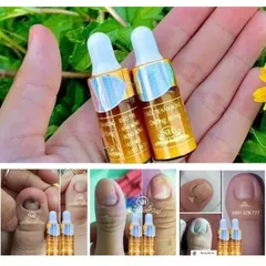 Serum Phục Hồi Móng - Combo 2 Chai 4ml Trị Nấm Móng, Hư Khoé, Bọng Móng - Giải Pháp Chăm Sóc Móng Chân Tay Hiệu Quả
