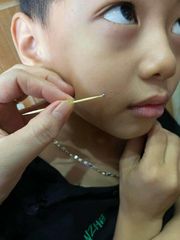 Kem Tẩy Nốt Ruồi Tàn Nhang Tại Nhà - An Toàn, Hiệu Quả Cho Mụn Thịt, Mụn Cóc, Đồi Mồi - Sản Phẩm Mỹ Phẩm Đáng Tin Cậy