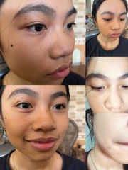 Kem Tẩy Nốt Ruồi Tàn Nhang Tại Nhà - An Toàn, Hiệu Quả Cho Mụn Thịt, Mụn Cóc, Đồi Mồi - Sản Phẩm Mỹ Phẩm Đáng Tin Cậy