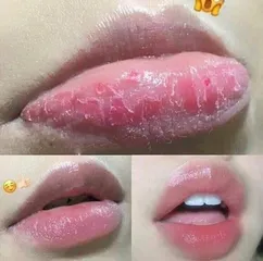 Set Tái Sinh Môi Mầm Gạo Lro’Cre - Khử Thâm, Dưỡng Ẩm và Làm Hồng Môi, Ngăn Khô Nẻ, Siêu Dưỡng Mềm Mại, Tẩy Da Chết Môi Chất Lượng Cao