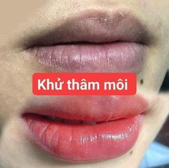 Combo Dưỡng Môi Collagen Thiên Di - Cấy Hồng Môi Giảm Thâm, Tự Nhiên Không Cần Phun Xăm, Mềm Mịn  - Làm Đẹp Da Môi