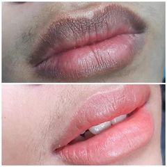 Combo Dưỡng Môi Collagen Thiên Di - Cấy Hồng Môi Giảm Thâm, Tự Nhiên Không Cần Phun Xăm, Mềm Mịn  - Làm Đẹp Da Môi