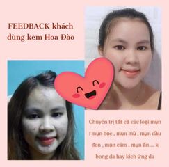 Combo 2 Lọ Kem Khử Mụn Hoa Đào - Loại Bỏ Thâm Mụn, Dưỡng Da Trắng Hồng Tự Nhiên Trong 2 Tuần - Hỗ Trợ Da Sáng Mịn, Kháng Khuẩn An Toàn
