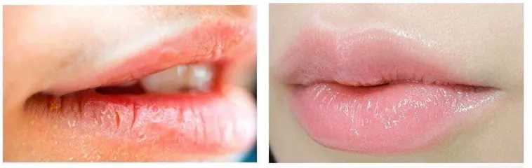 Son Dưỡng Môi Mầm Gạo Siêu Dưỡng Ẩm, Tẩy Da Chết Môi, Khử Thâm, Môi Căng Mọng, Hồng Hào - Mỹ Phẩm Tự Nhiên Dưỡng Môi