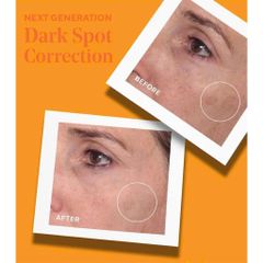 Serum Murad Rapid Dark Spot Correcting (Bản Mới) | Tinh chất dưỡng sáng, giảm nám, làm mới bề mặt da