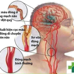 Viên uống bổ tim mạch Qunol Ultra CoQ10 100mg 80 viên, tim khỏe