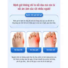 Gel lạnh thoa giảm đau khớp - Cải thiện sưng viêm, đau nhức ngón tay, đầu gối, chân - Giải pháp tự nhiên hiệu quả cho sức khỏe