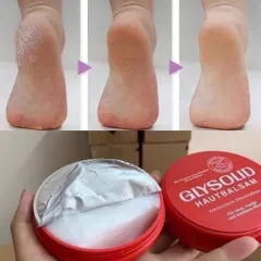 Kem Glysolid Đức dưỡng mềm da loại bỏ khô ráp nứt nẻ gót chân, tay 403321