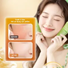 Tẩy Da Chết Dr.Pepti Centella Turnover Soft Peeling 100ml -  Chiết Xuất Rau Má, Làm Sạch Sâu, Dịu Da