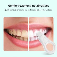 Bộ 3 Khăn Lau Làm Sạch Răng Trẻ Em - Loại Bỏ Tartar và Vết Bẩn, Miếng Bọt Biển An Toàn, Dễ Dàng Sử Dụng, Tiết Kiệm Chi Phí