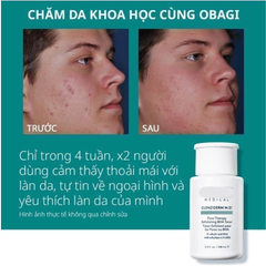 Toner BHA Obagi Clenziderm Pore Therapy 2% Salicylic Acid 148ml - Giảm Mụn, Làm Sạch Sâu, Chăm Sóc Da Dầu và Da Mụn