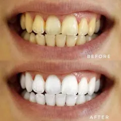 Set Kem đánh răng colgate Mỹ optic white hàng Mỹ