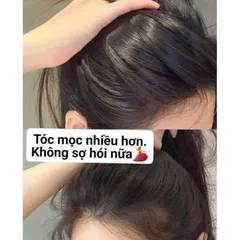 Viên Uống Hỗ Trợ Mọc Tóc Biotin 10000mcg Natrol Beauty Chính Hãng - Giúp Tóc Đẹp, Chắc Khỏe, Ngăn Rụng Tóc 100 Viên