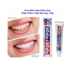 Kem Đánh Răng Nhật Bản White & White Lion 150g - Làm Trắng Răng, Diệt Khuẩn, Hương Bạc Hà Tươi Mát, Sáng Bóng, An Toàn cho Nướu nhạy cảm