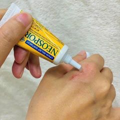 Kem mỡ Neosporin + Pain Relief 14.2g - Giảm đau, hỗ trợ liền sẹo nhanh chóng, sản phẩm chăm sóc da hiệu quả từ Mỹ