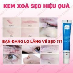 Kem Loại Bỏ Sẹo Tự Nhiên - Làm Mờ Sẹo Mụn, Sẹo Sau Phẫu Thuật, Dưỡng Ẩm Da - Hiệu Quả Cho Tất Cả Các Loại Da 20ml