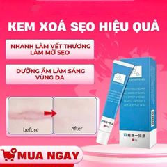 Kem Loại Bỏ Sẹo Tự Nhiên - Làm Mờ Sẹo Mụn, Sẹo Sau Phẫu Thuật, Dưỡng Ẩm Da - Hiệu Quả Cho Tất Cả Các Loại Da 20ml