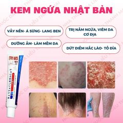 Kem Bôi Chăm Sóc Da Nhật Bản - Giảm Ngứa, Dưỡng Ẩm, Hỗ Trợ Cải Thiện Lác Đồng Tiền, Nấm Da Đầu, Á Sừng