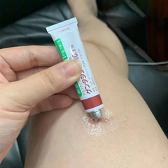 Kem Giảm Mụn, Giảm Sẹo Gentacin Inomata 10g - Hỗ Trợ Làm Lành Da, Kháng Khuẩn, Chăm Sóc Da Tổn Thương Nhật Bản