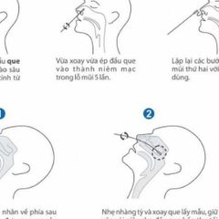 Que Test Nhanh Covid-19 Onsite Tại Nhà - Bộ Xét Nghiệm Kháng Nguyên SARS-CoV-2, 20 Test/Hộp, Kết Quả Trong 15 Phút