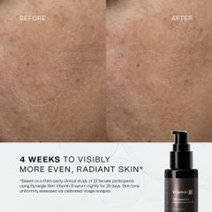 Serum Vitamin B 13% Synergie Skin - serum Dưỡng ẩm,sáng da thu nhỏ Chân lông 30ml