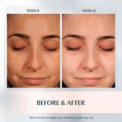 Serum Eucerin Anti-Pigment Dual 30ml - Tinh Chất Mờ Thâm Nám, Cấp Ẩm Rạng Rỡ, Dưỡng Sáng Da 2 Trong 1