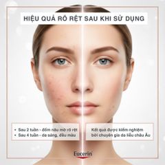 Tinh Chất Serum Eucerin Anti-Pigment 30ml - Hỗ Trợ Mờ Thâm, Sáng Da Cho Da Dầu - Dưỡng Ẩm, Kết Cấu Nhẹ Mịn