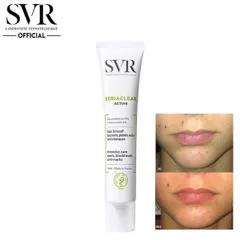 Kem Dưỡng SVR Sebiaclear Active Gel 40ml - Hỗ Trợ Giảm Mụn, Mờ Thâm, Kiểm Soát Dầu Nhờn với 14% Gluconolactone và Niacinamide