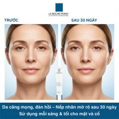 Kem Dưỡng Ẩm Hyalu B5 Rich Care 40ml – Chống Lão Hóa, Giảm Nếp Nhăn, Da Mềm Mượt