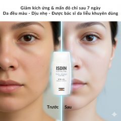 Kem Chống Nắng Isdin FotoUltra Solar Allergy Fusion Fluid SPF50+ - Bảo Vệ Da Nhạy Cảm, Dưỡng Ẩm và Làm Dịu Da 50ml