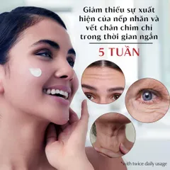Kem Dưỡng Eucerin Q10 Anti-Wrinkle 48g - Chăm Sóc Da Nhạy Cảm, Cấp Ẩm Sâu, Làm Mờ Nếp Nhăn, Dưỡng Da Mịn Màng