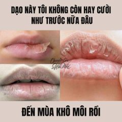 Son dưỡng môi Eucerin Lip Active SPF20 hỗ trợ giảm khô nứt 4.8g
