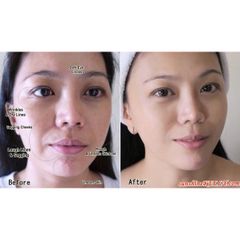 Tinh Chất Eucerin Hyaluron-Filler + Elasticity 3D Serum 30ml - Giảm Nếp Nhăn & Mờ Đốm Nâu cho Da Lão Hóa, Căng Mịn Rạng Rỡ