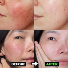 Kem Bảo Vệ & Phục Hồi Da Avène Cicalfate+ SPF50+ - Chống Nắng, Dưỡng Ẩm, Làm Dịu Da Nhạy Cảm, Phục Hồi Tổn Thương Da