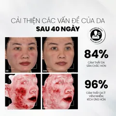 [Tặng SRM 30ml] Serum Cân Bằng lợi khuẩn phục hồi hàng rào bảo vệ da , ráo dầu ngăn ngừa Mụn MD Care NMF Prebiotics 