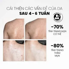 Xịt Tẩy Tế Bào Body MD Care 100ml - Sản phẩm chăm sóc body tự nhiên, làm sạch và tái tạo giảm mụn body